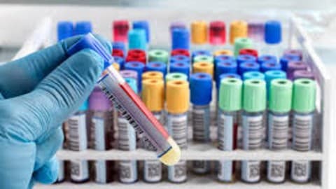 Important Medical Investigations for Medical Board Exams